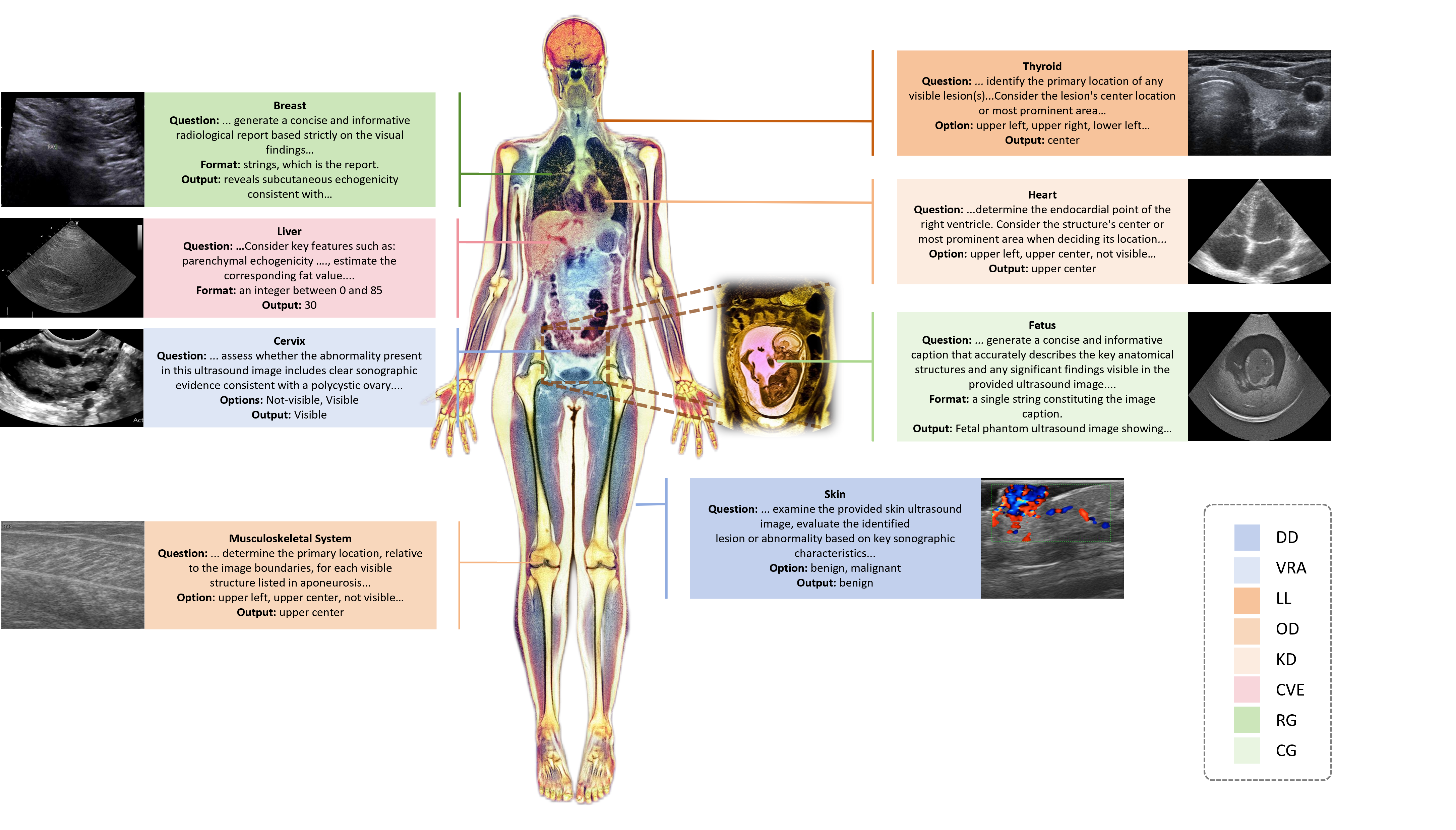 U2-BENCH benchmarking LVLMs on ultrasound